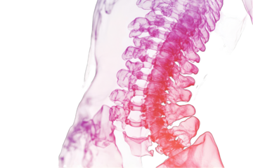A stylized, colorized X-ray or scan depicting the human spine in profile view, showcasing vertebrae and intervertebral discs with varying color intensities