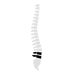 Spinal fracture vector illustration