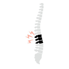 Spinal fracture vector illustration