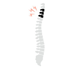 Spinal fracture vector illustration