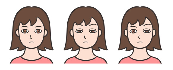 眼瞼下垂の目をした女性の顔と正常な状態