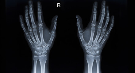 Detailed X-Ray Image of Human Hands Anatomy, Bones, and Joints Visualization