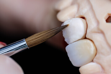 Dental prosthesis work. Teeth painting. Technician applies ceramic material to the crown of a dental implant using a brush.