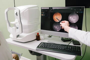 Retinal scan analysis for vision health, optic nerve evaluation, and early detection at ophthalmology. Ophthalmologist examines retina images on screen, diagnosing glaucoma and macular degeneration.
