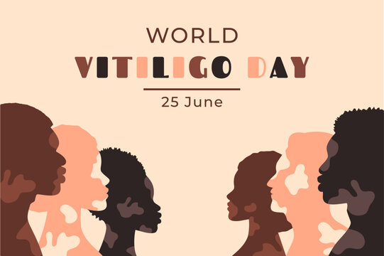 World vitiligo day. Diverse women and men with vitiligo patches. Human silhouettes of various nationality. Skin diversity concept. Body positive and self love. Vector illustration
