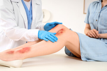Female doctor examining patient's bruised legs on couch in clinic, closeup