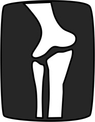 Illustration of an elbow joint x-ray