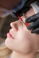 Caucasian woman undergoing eyelash lamination procedure. 