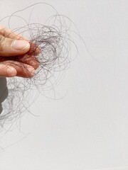 The image show of hand holding hair lose
