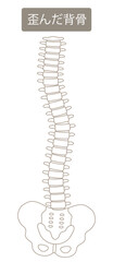 歪んだ背骨