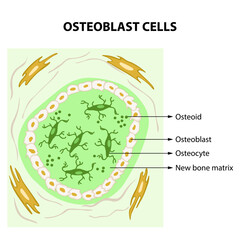 Osteoid: The Building Block of New Bone