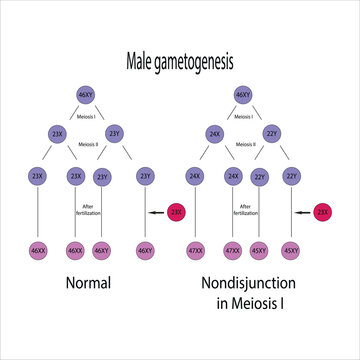 Male Gametogenesis Normal and Nondisjunction in Meiosis I