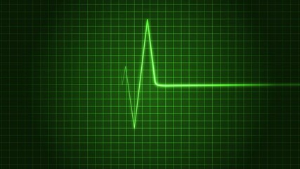 Heartbeat Signal Line Animation for Healthcare and Cardiology Themes - Powered by Adobe
