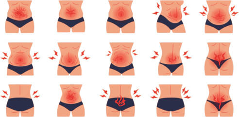 vector set of Bloating icons set. People experiencing digestive problems, discomfort, and symptoms related to stomach and gut health
