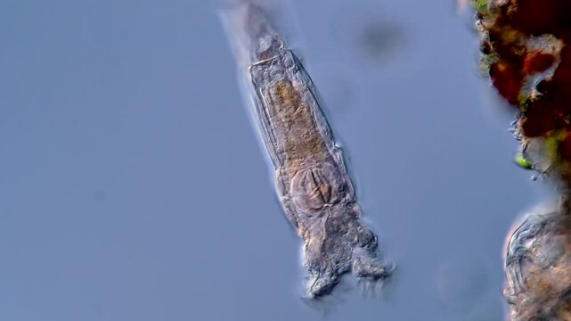 Rotifera under microscope 400x magnification 
