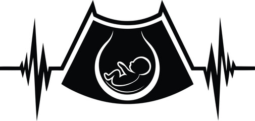 Ultrasound vector icon illustration, ultrasound silhouette vector art, ultrasound silhouette vector illustration