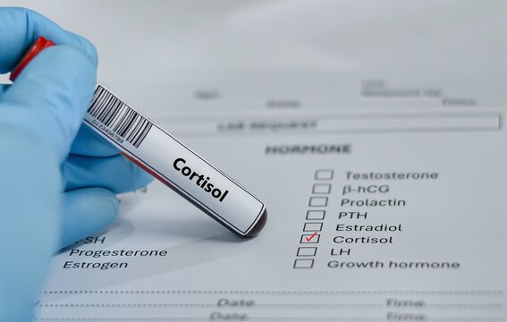 Blood sample tube for cortisol test analysis