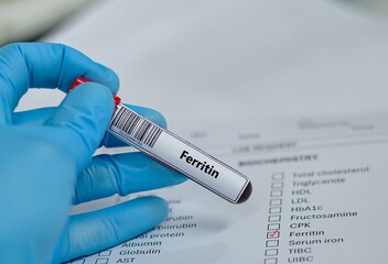 Naklejka premium Blood sample tube for ferritin test analysis.