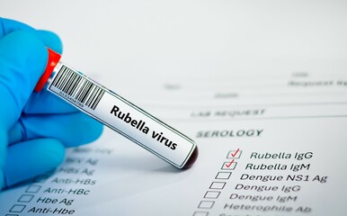Fototapeta premium Blood sample tube for rubella virus test analysis.