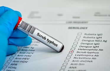 Blood sample tube for scrub typhus test analysis.