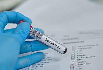 Obraz premium Blood sample tube for serum iron test analysis.