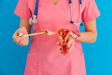 doctor gynecologist pointing model of female reproductive system