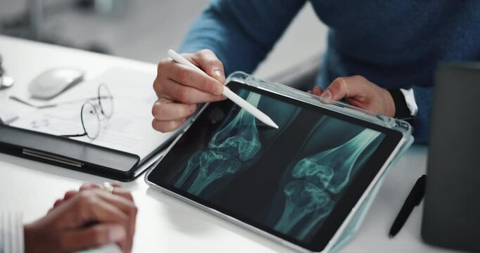 Hands, tablet and doctor with x ray, knees and consulting with results for patient at hospital. People, medical review and radiology scan for legs, bones and injury with consultation at clinic