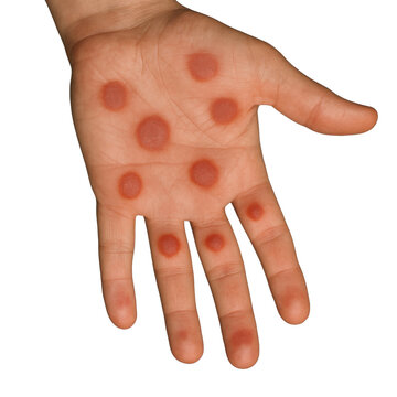 Yotoq xonasida yashirin kamera xxx