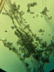 Fungal sporangium and hyphae under light microscop