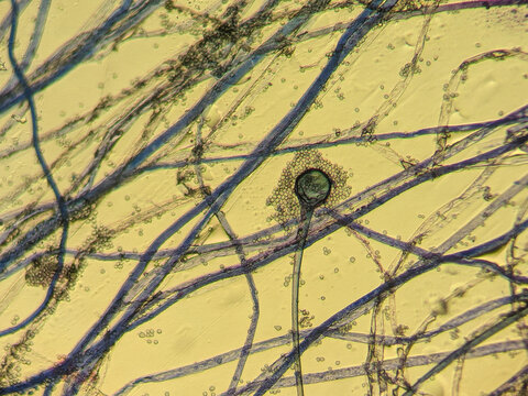 Fungal sporangium and hyphae under light microscop