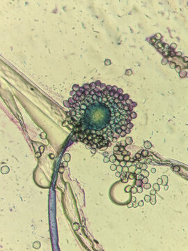 Aspergillus fungus structure under compound light microscop
