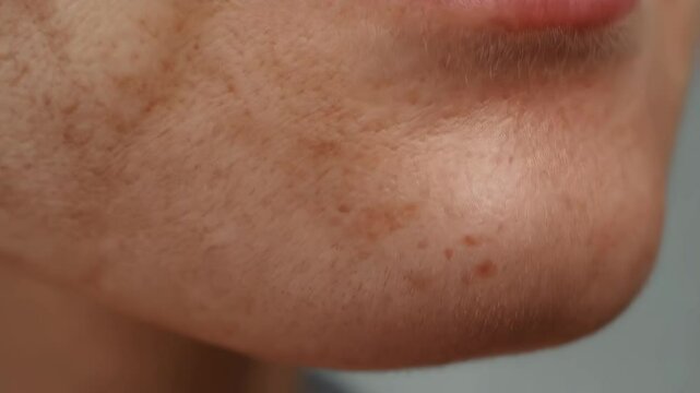 Close up of human facial skin with freckles, pigmentation, and texture detail around mouth and nose showcasing aging and imperfections.