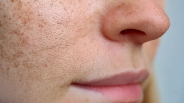 Close-up view of woman's face showing skin texture and freckles, natural light, skincare concept, dermatology visual