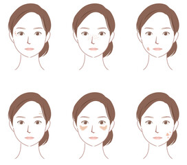 顔にできたシミの種類　美容　女性