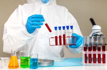 examine blood in the laboratory. Selective focus.