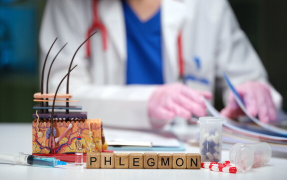 A medical professional handling documents, showcasing phlegmon and lab equipment in a clinical environment.