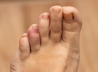 Fototapeta premium A foot with a red mark on it