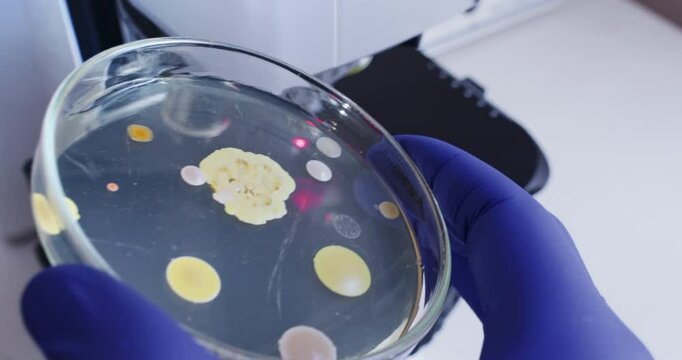 Petri dish with bacterial colonies at an angle close-up in a scientist's hand against a microscope background.