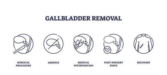 Gallbladder removal is shown with outline icons of surgery, absence, intervention, post-surgery, and recovery, transparent background. Outline icons set