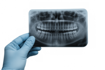 Dentist wearing gloves holding panoramic dental x-ray on transparent background