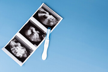 Positive pregnancy test with gynecological ultrasound image, symbolizing pregnancy, family planning, and maternal health. Concept of starting a family, prenatal care, and expecting a baby.