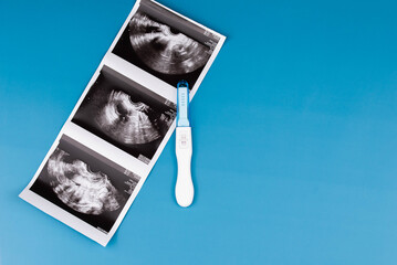 Positive pregnancy test with gynecological ultrasound image, symbolizing pregnancy, family planning, and maternal health. Concept of starting a family, prenatal care, and expecting a baby.