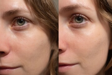 Comparison of Focus Level With Caffeine and Without Caffeine Showing Noticeable Differences