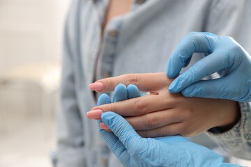Doctor examining woman's moles in hospital, closeup