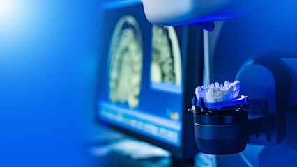 Dental 3D scanning system analyzing a jaw model with a digital screen in the background displaying dental imaging for CAD/CAM dentistry.