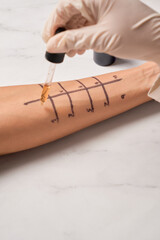 Skin prick allergy to find out kind of allergy