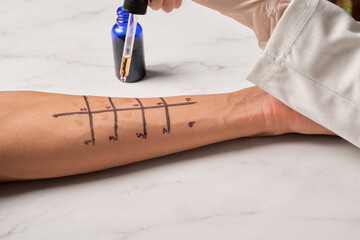Doctor making allergy skin test on patient's hand in clinic