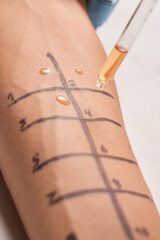 Doctor testing allergy reaction of patient in hospital