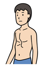 Fototapeta premium 漏斗胸の男性、胸郭変形