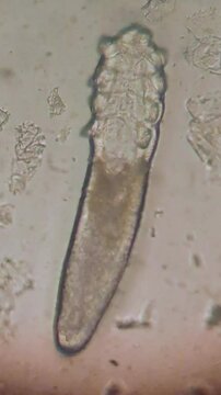 Demodex Mite: Time-Lapse Microscopic Movement